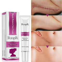 Creme Rejuvenescedor Removedor de Cicatriz - RtopR®